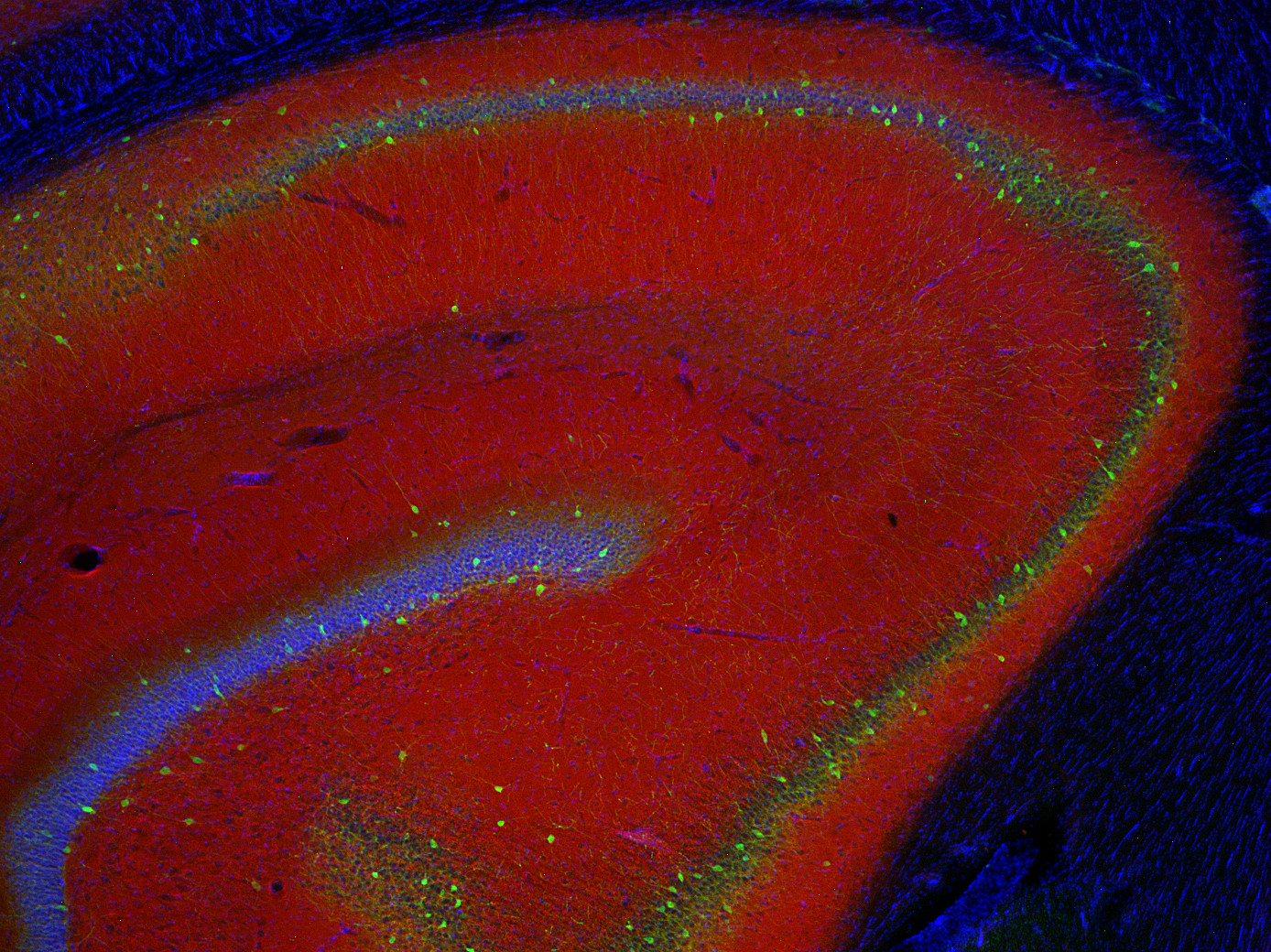 Synaptotagmin1 Polyclonal rabbit antiserum - image 4