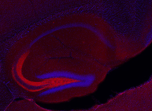 Synapsin3 Polyclonal Guinea pig antiserum - image 3