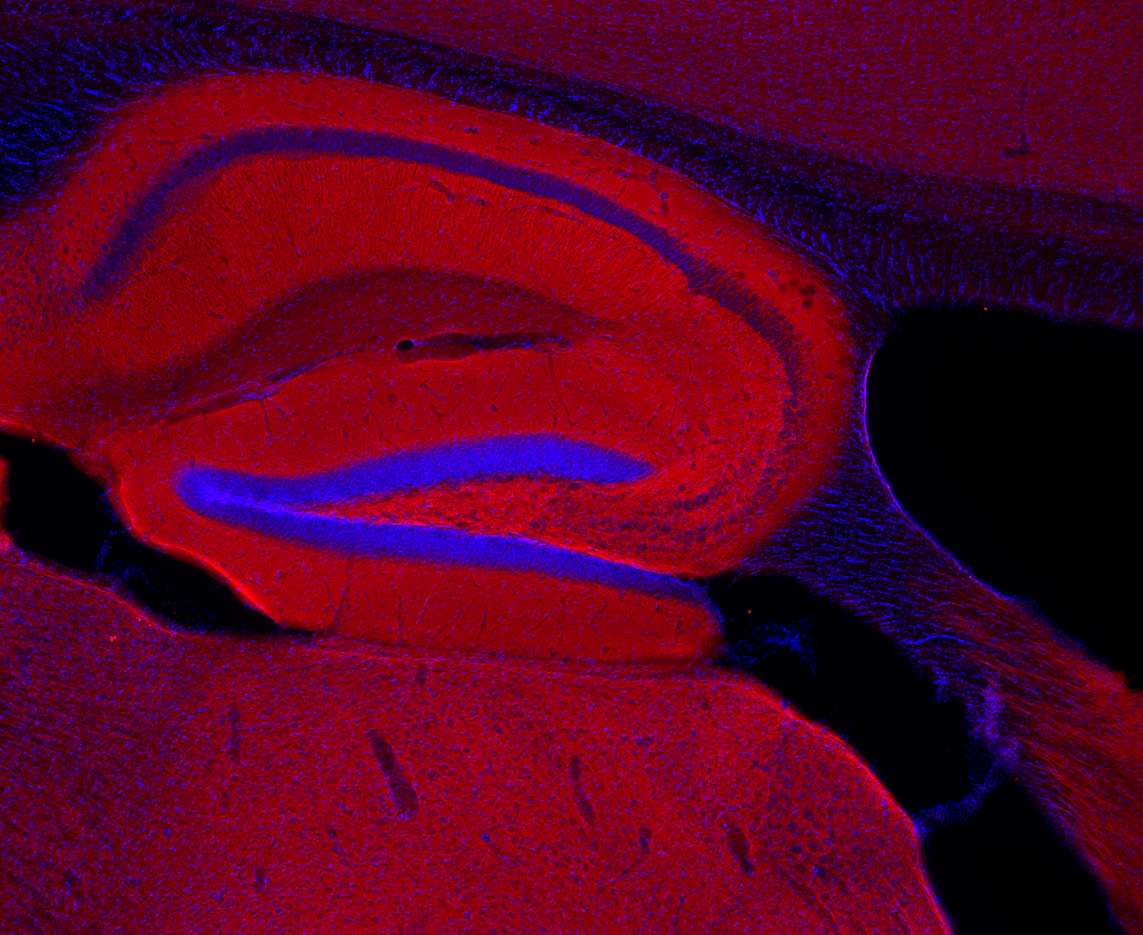 Rab3a Polyclonal rabbit antiserum - image 4