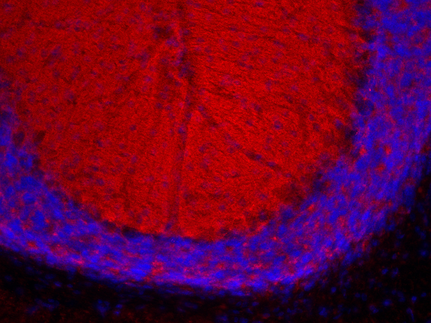 Rab3a Polyclonal rabbit antiserum - image 5