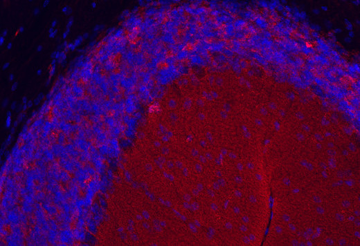 Clathrin light chain Monoclonal mouse purified IgG - image 3