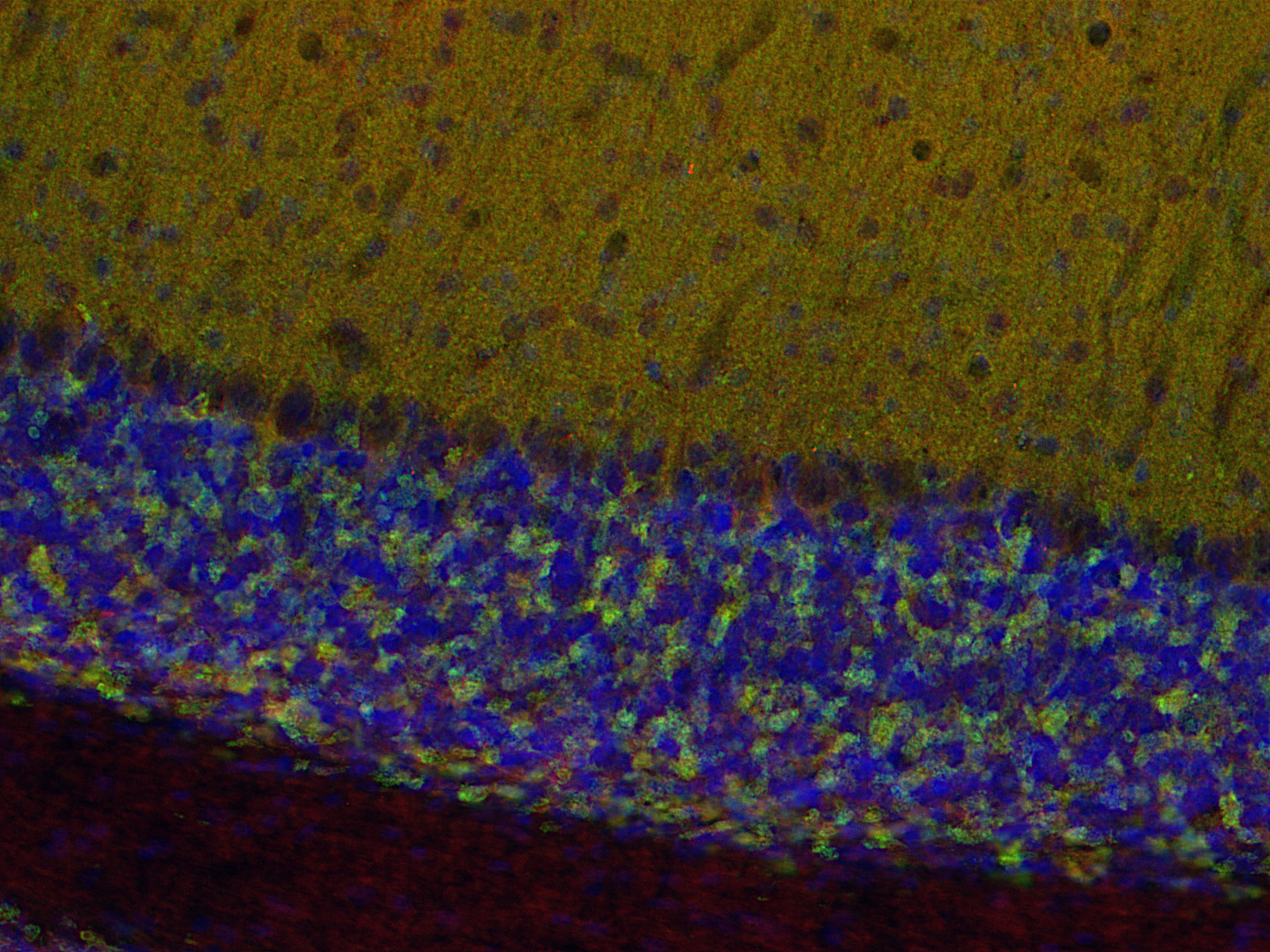 Dynamin1/2/3 Polyclonal rabbit antiserum - image 3