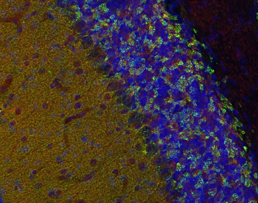 Dynamin1/2/3 Polyclonal rabbit purified antibody - image 3