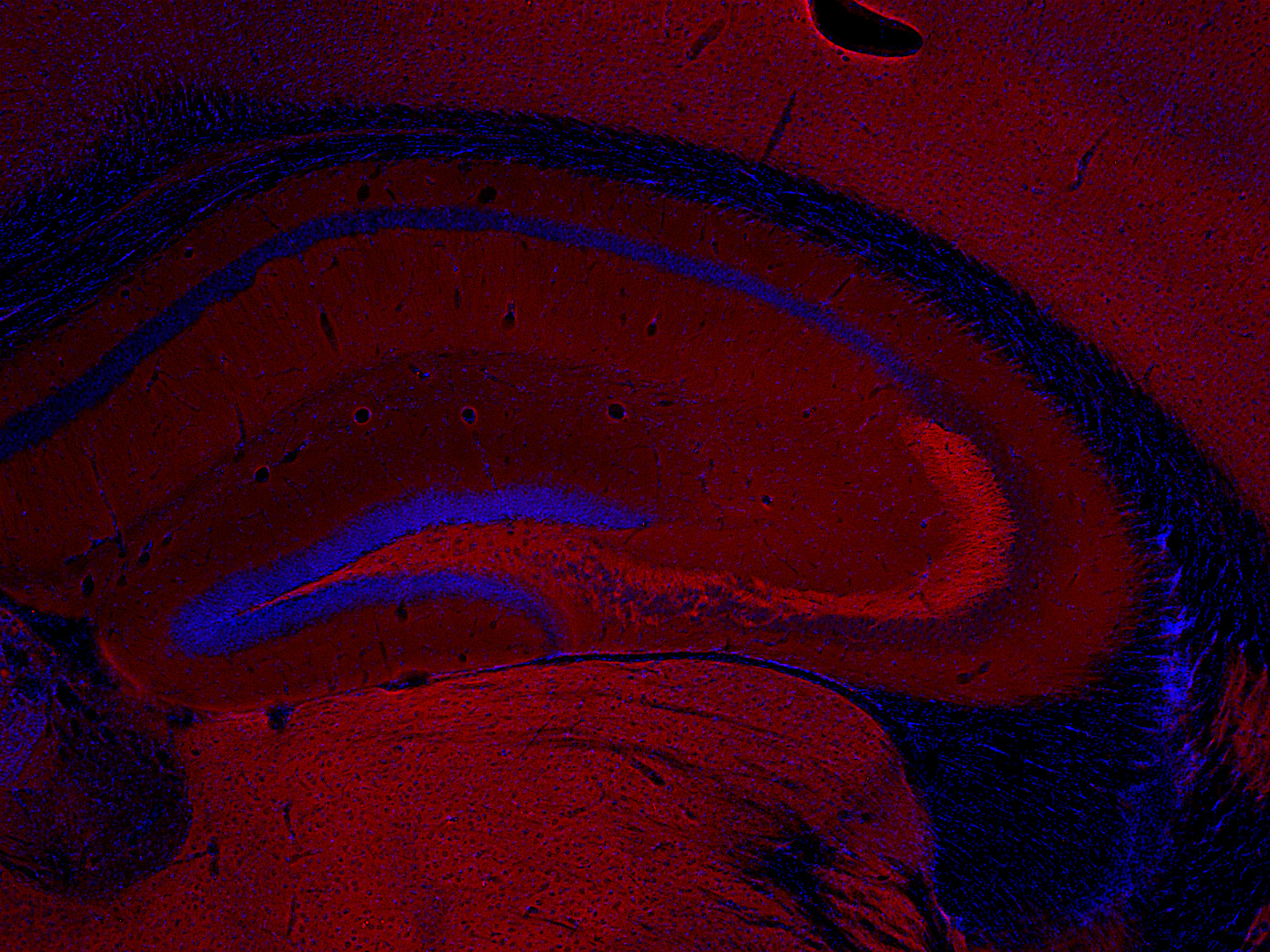 Munc18-1 Polyclonal rabbit antiserum - image 3