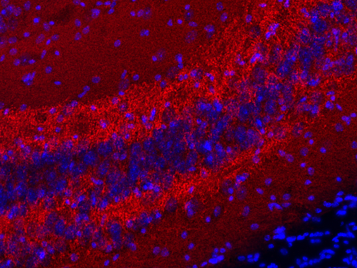 SV2 A Polyclonal rabbit antiserum - image 3