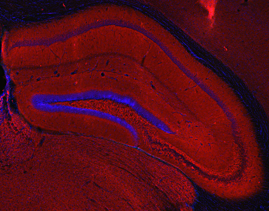 SV2 A, Polyclonal Guinea pig antiserum