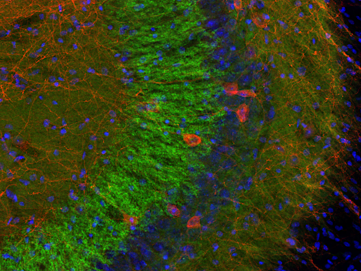 SV2 A, Polyclonal Guinea pig antiserum