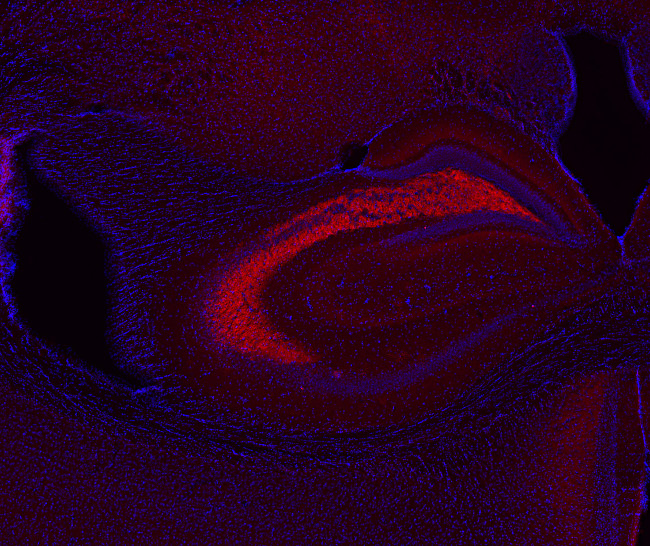 SV2 C Polyclonal rabbit antiserum - image 3