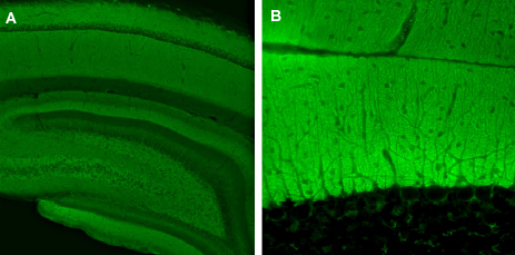 Complexin1/2 Polyclonal rabbit antiserum - image 3