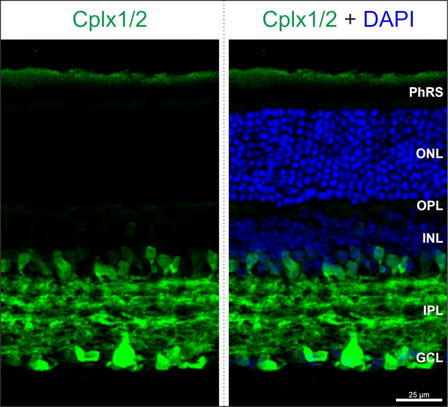 Complexin1/2 Polyclonal Guinea pig antiserum - image 4