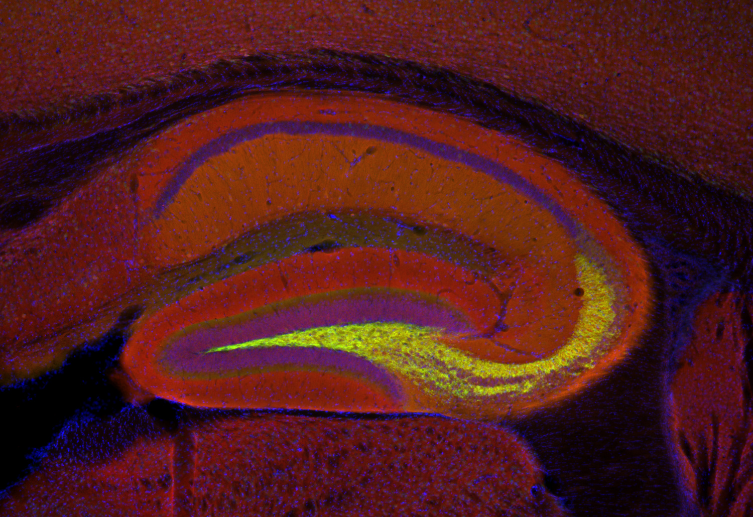 Complexin2, Polyclonal rabbit purified antibody