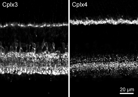 Complexin4 Polyclonal rabbit antiserum - image 2