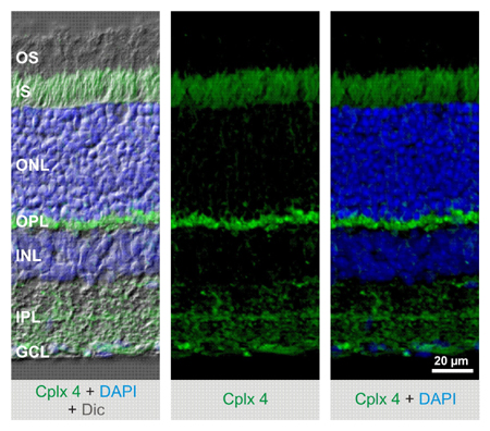 Complexin4 Monoclonal mouse purified IgG - image 2