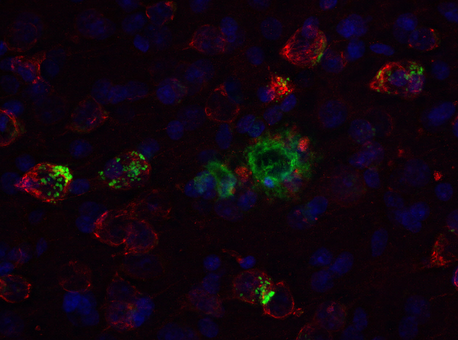 APP, Polyclonal rabbit antiserum