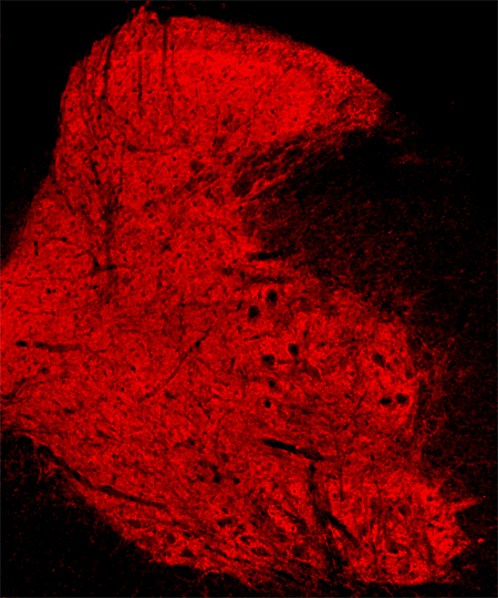 alpha/beta Synuclein Polyclonal rabbit antiserum - image 3