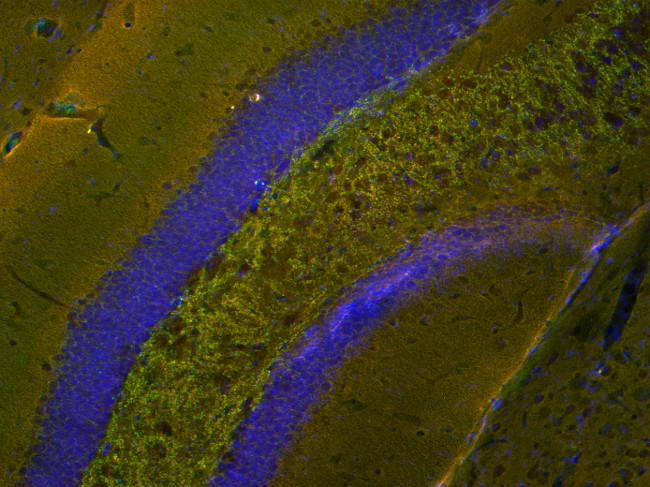 alpha/beta Synuclein Polyclonal rabbit purified antibody - image 3