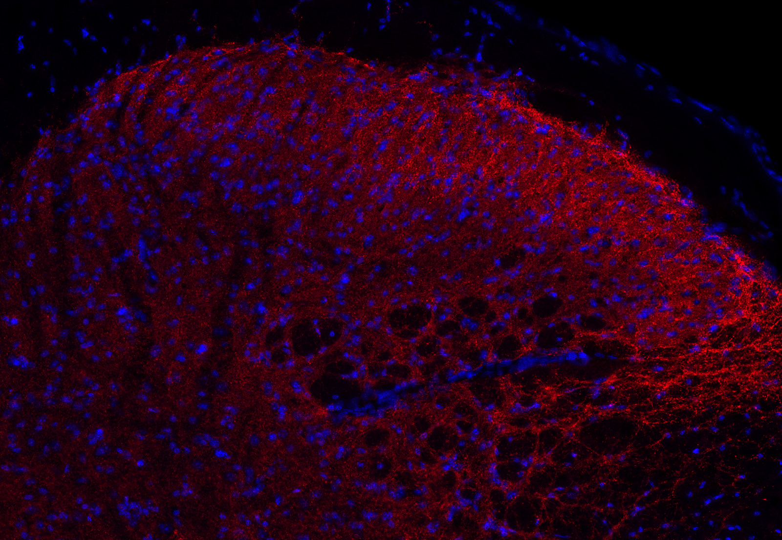 alpha Synuclein Recombinant rabbit - image 4