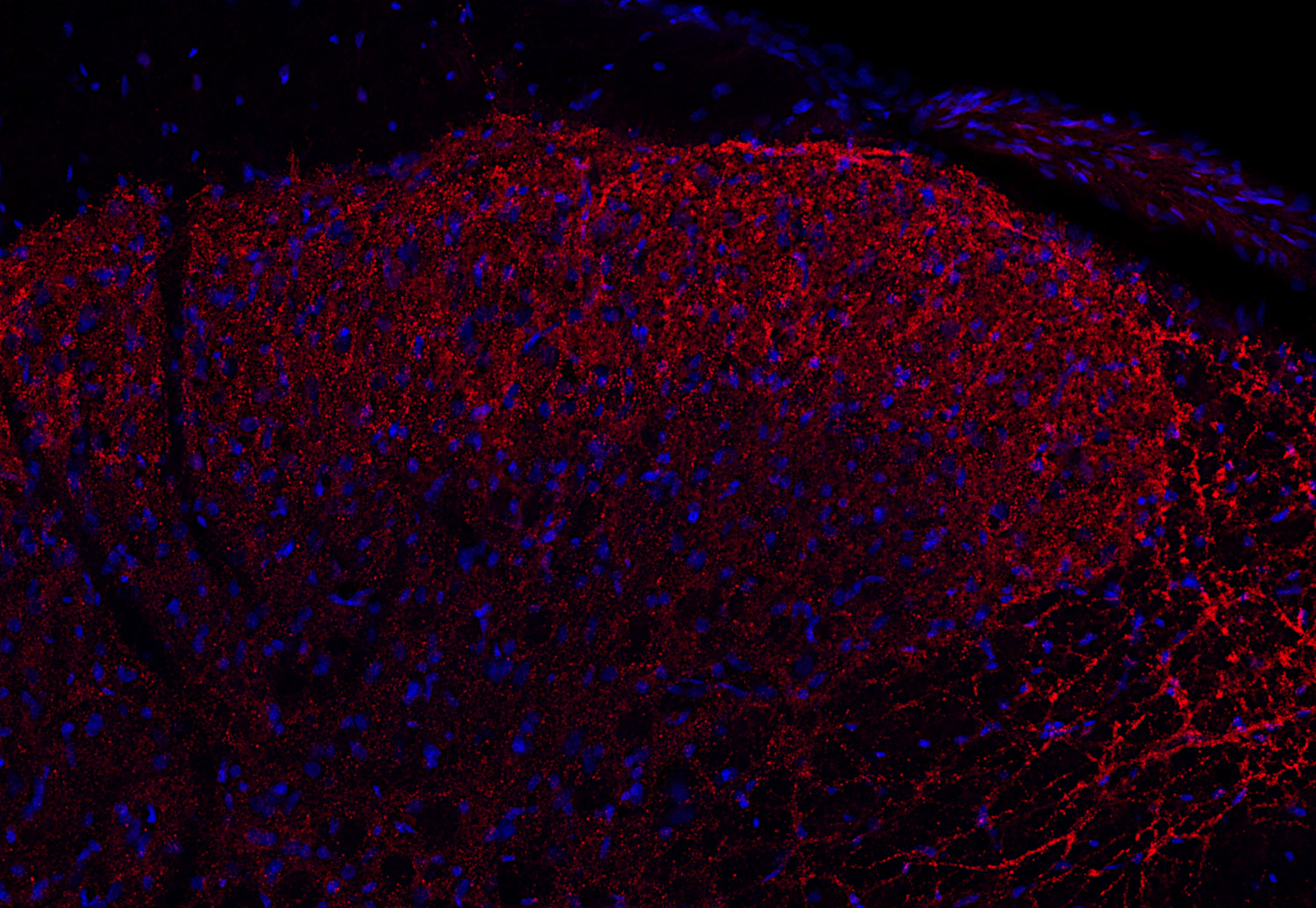 alpha Synuclein Recombinant rabbit - image 5