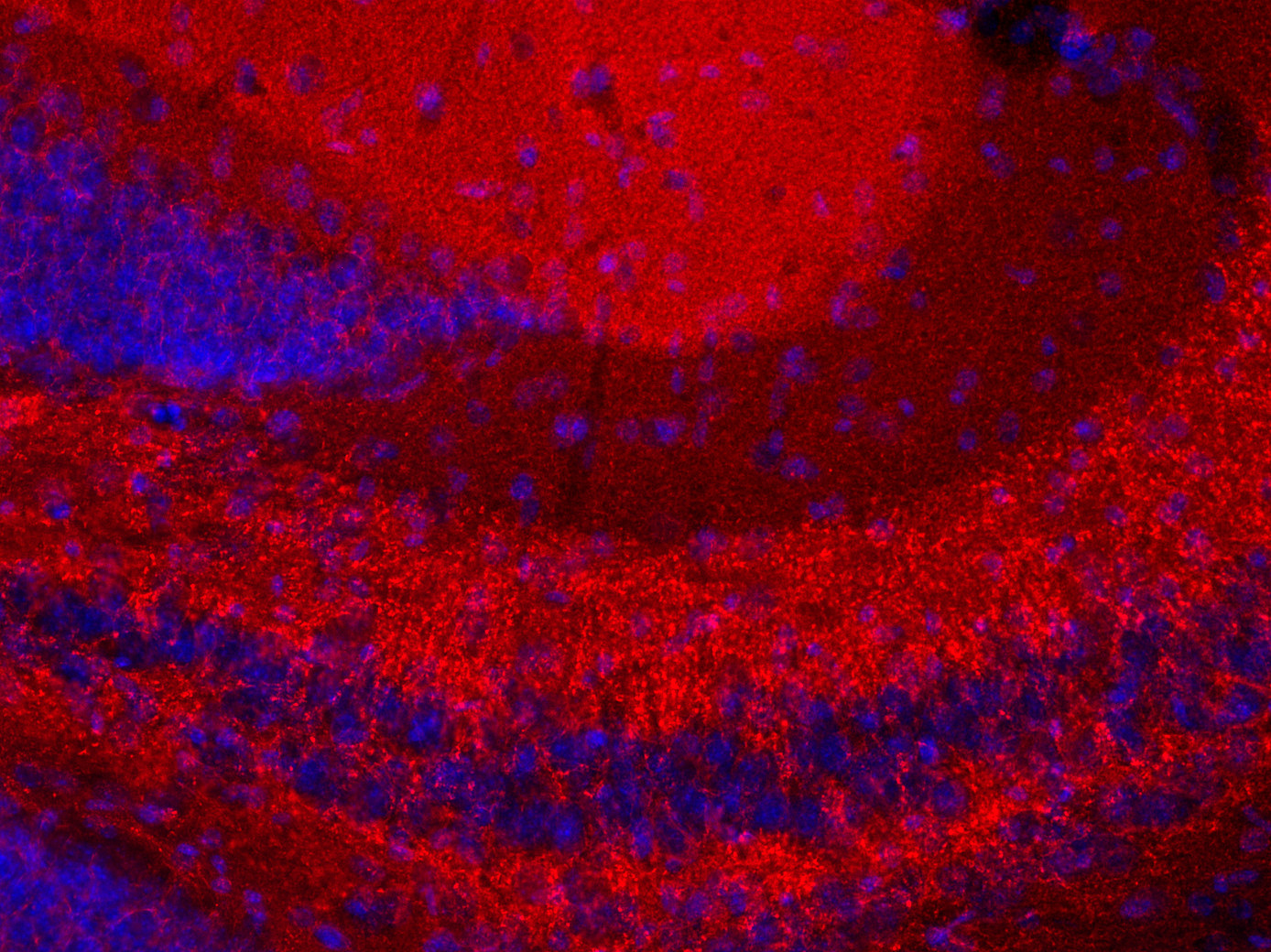 beta-Synuclein Polyclonal rabbit purified antibody - image 3
