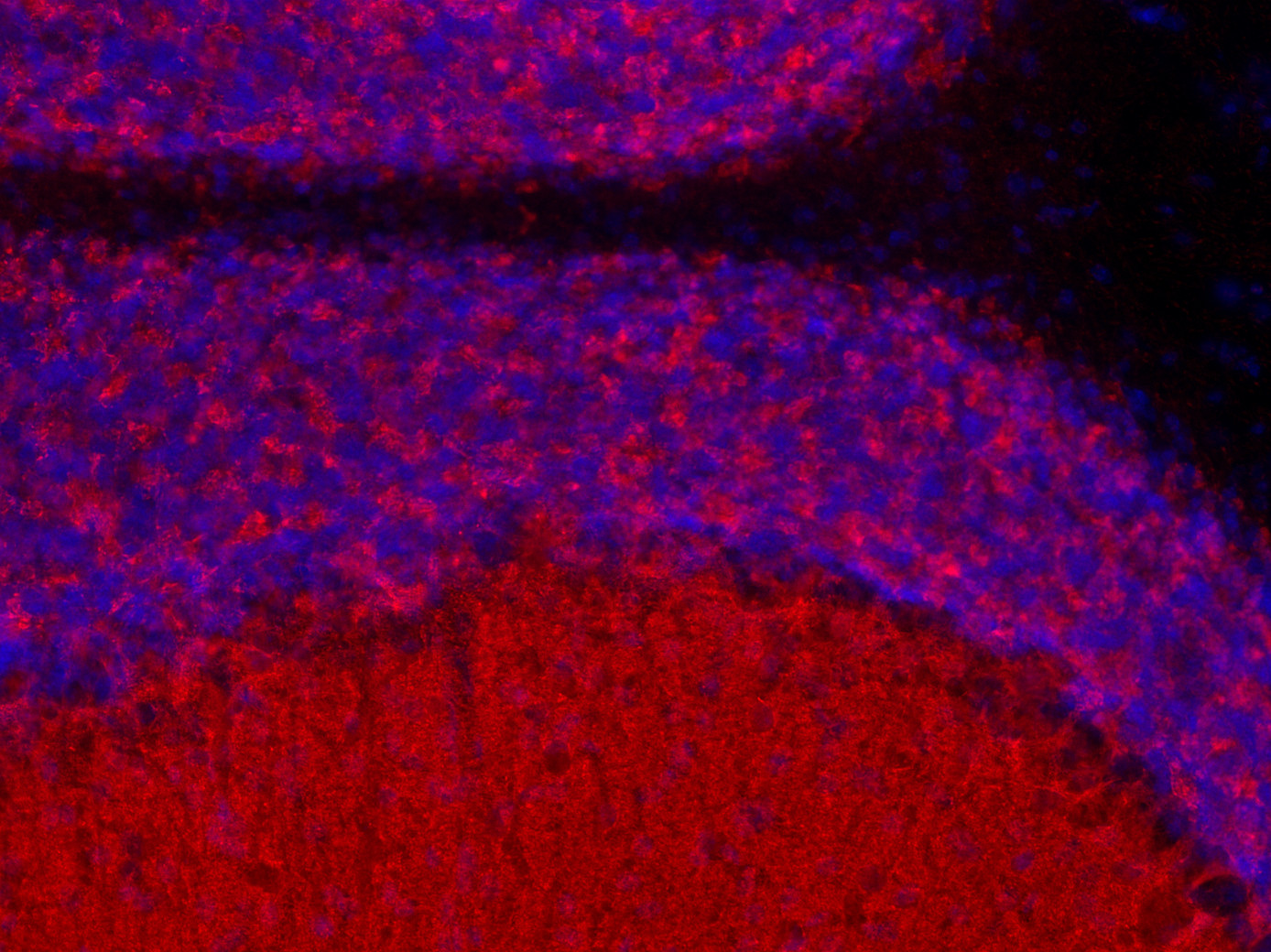 beta-Synuclein Polyclonal rabbit purified antibody - image 4