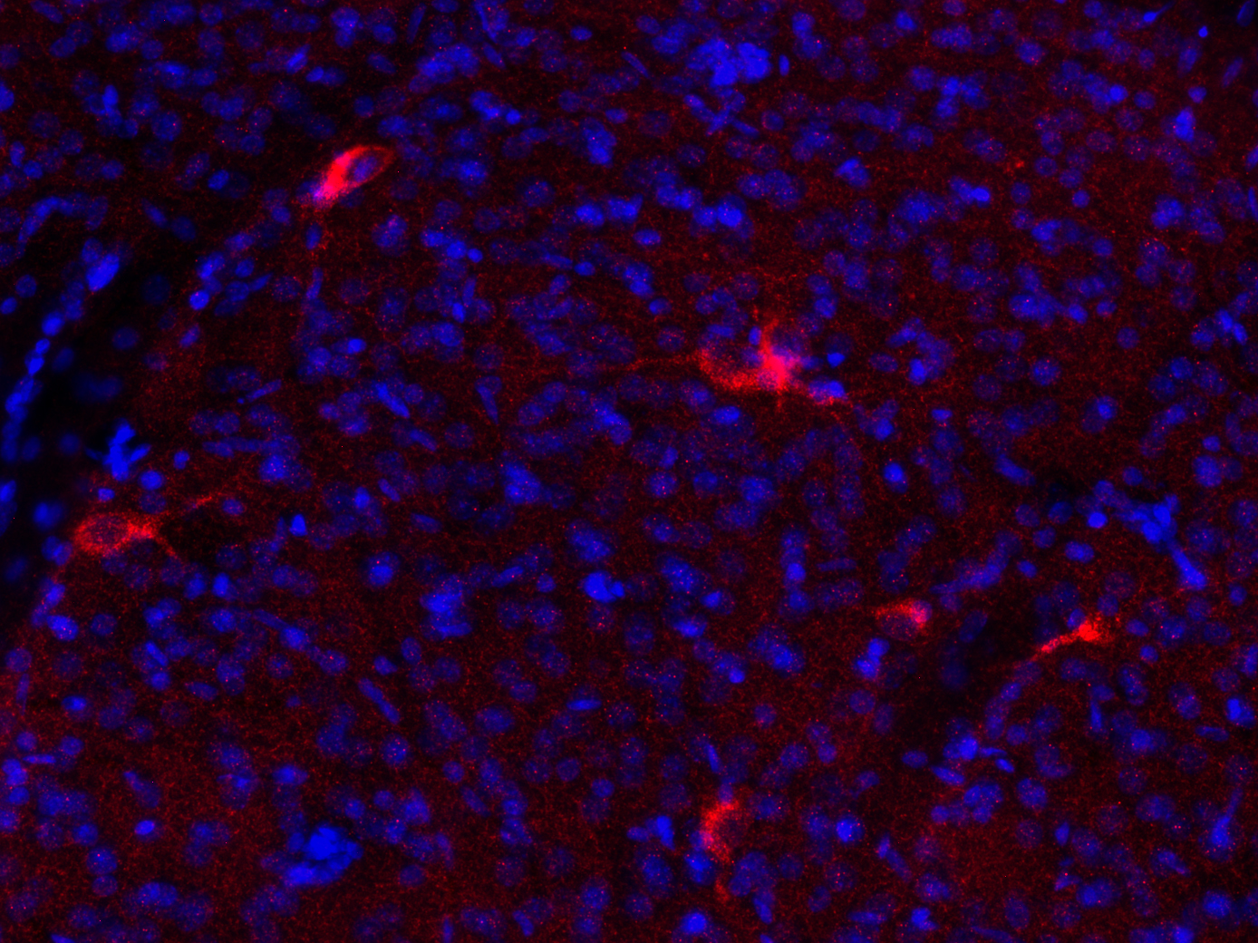 VGLUT3 Recombinant rabbit - image 2