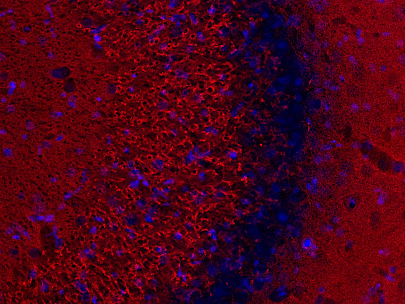 VGLUT1 Polyclonal rabbit antiserum - image 5