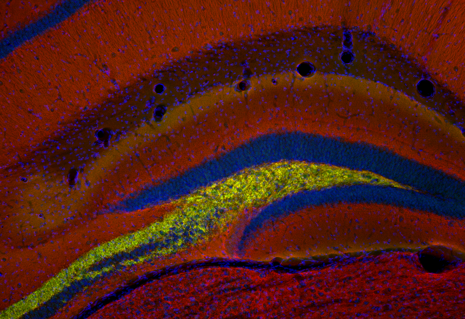 VGLUT1 Recombinant chicken - image 4