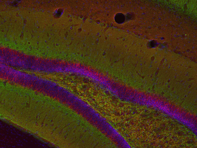 VGLUT2 Polyclonal chicken purified antibody - image 3