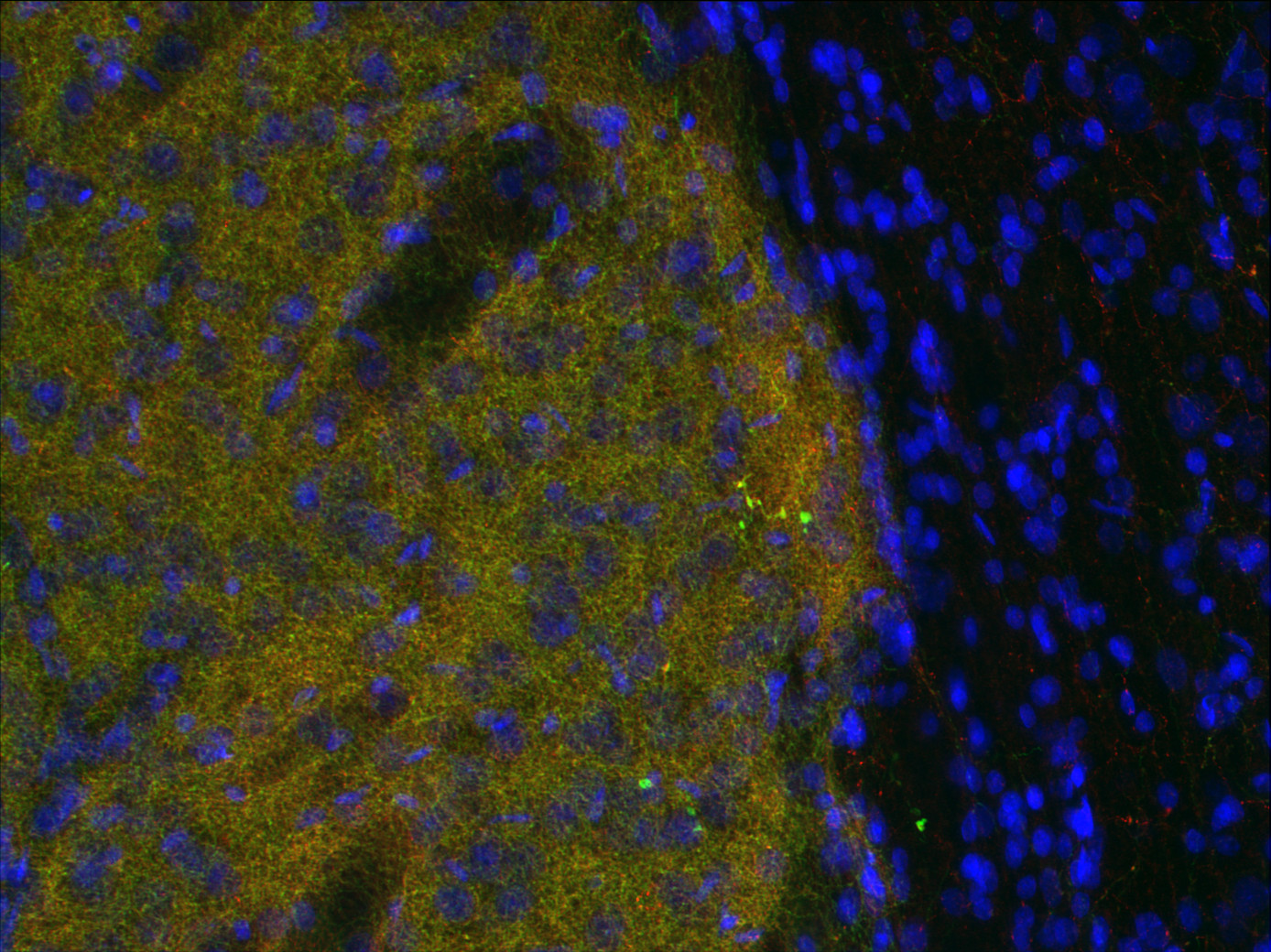 VMaT2, Polyclonal rabbit antiserum