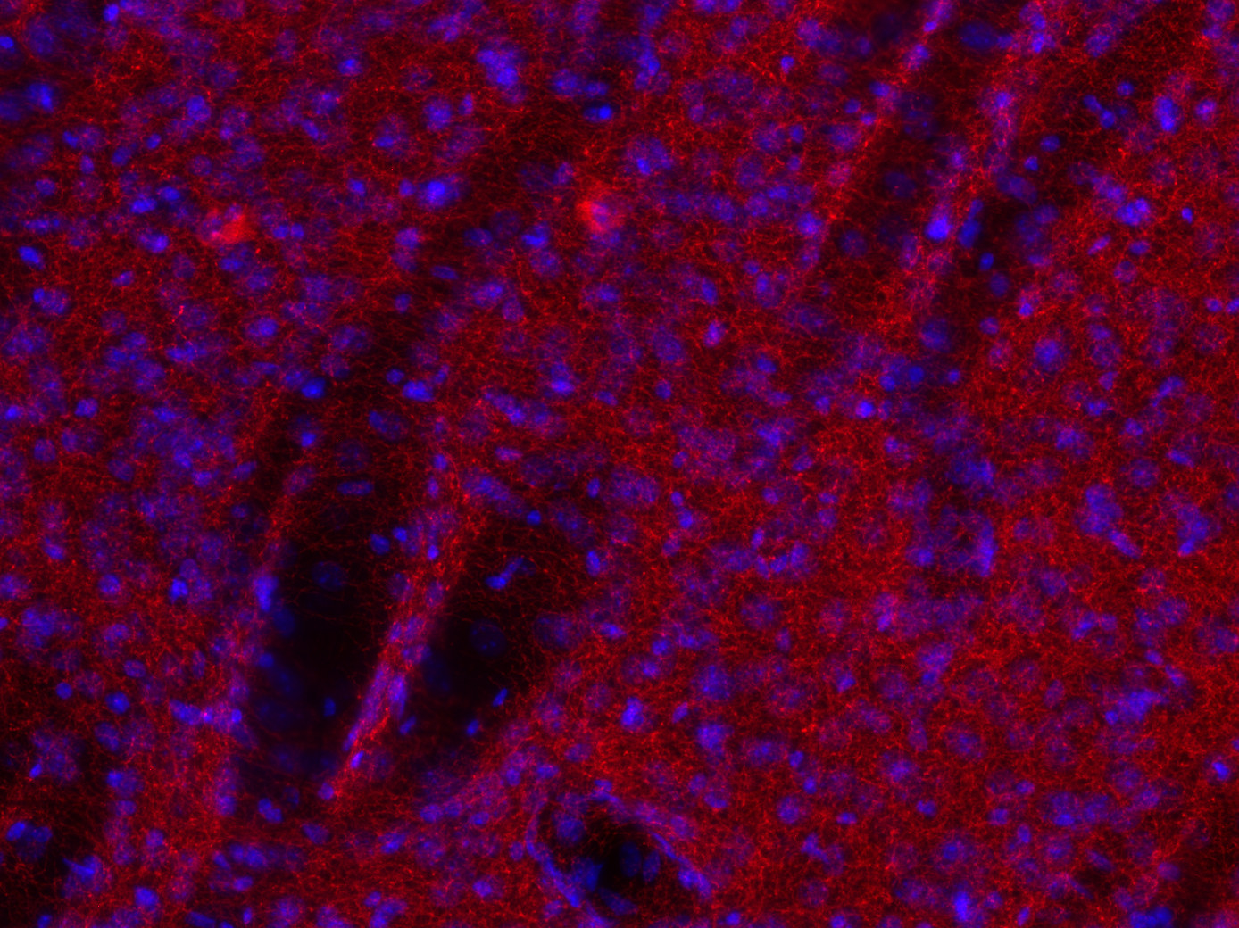 VAChT Recombinant rabbit - image 3