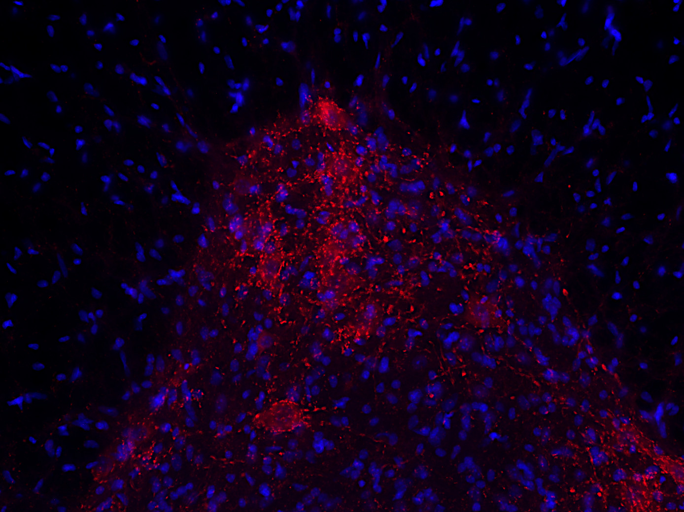 VAChT Recombinant rabbit - image 4