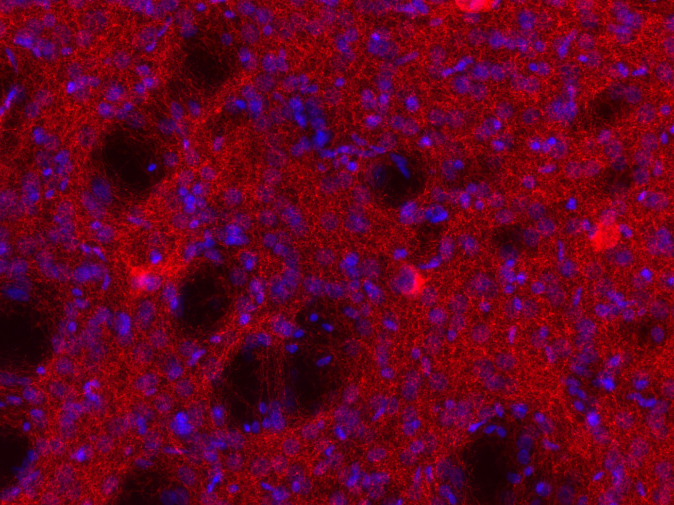 VAChT Recombinant rabbit - image 5