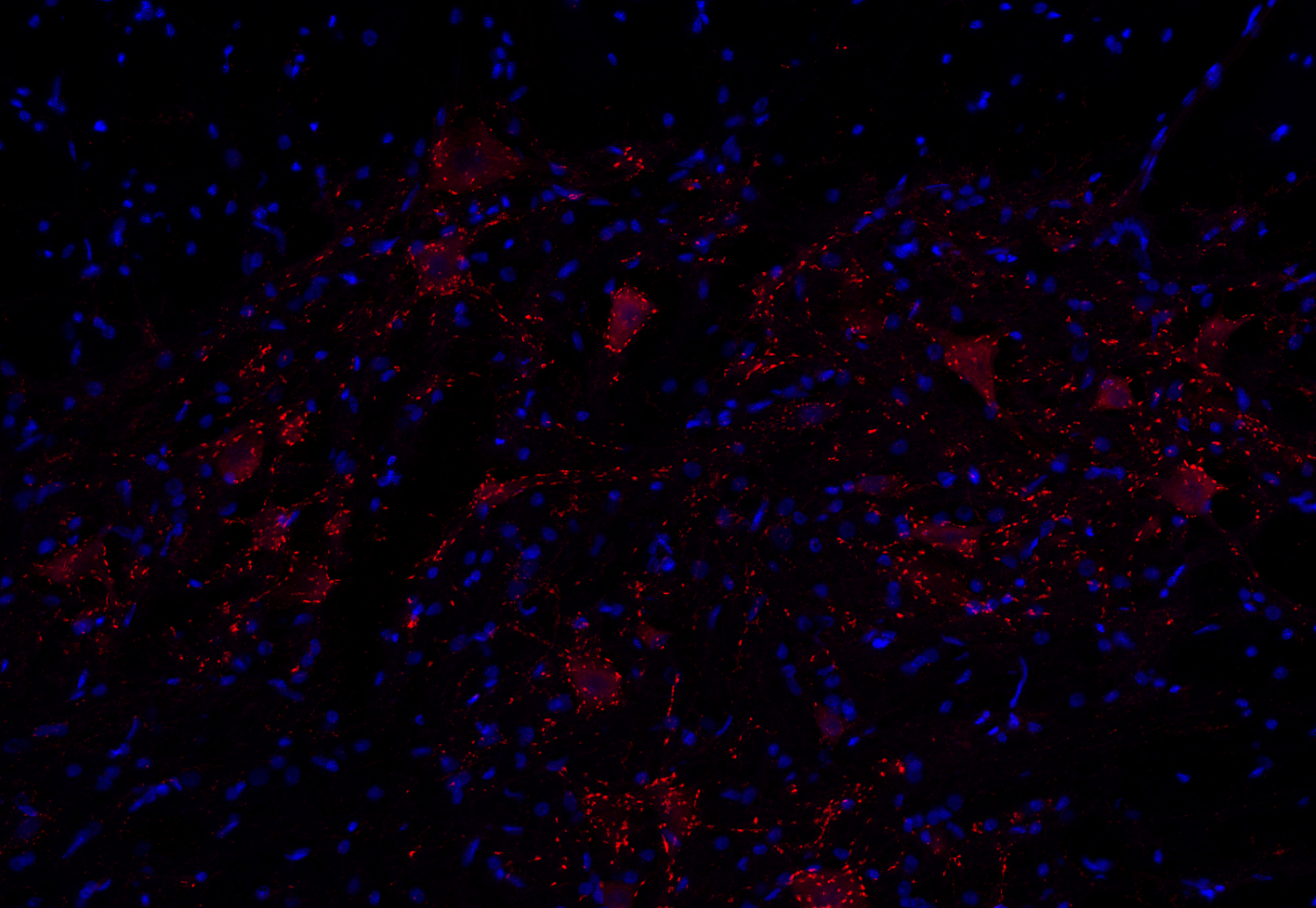VAChT Recombinant chicken - image 4