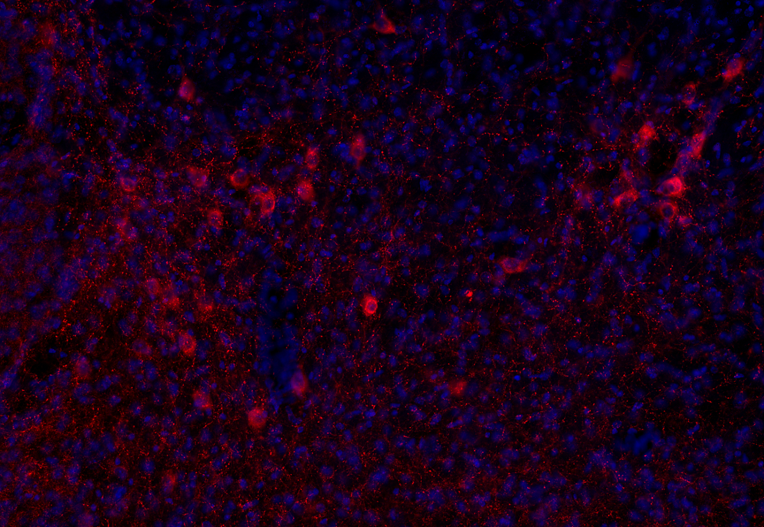 VAChT Recombinant chicken - image 5