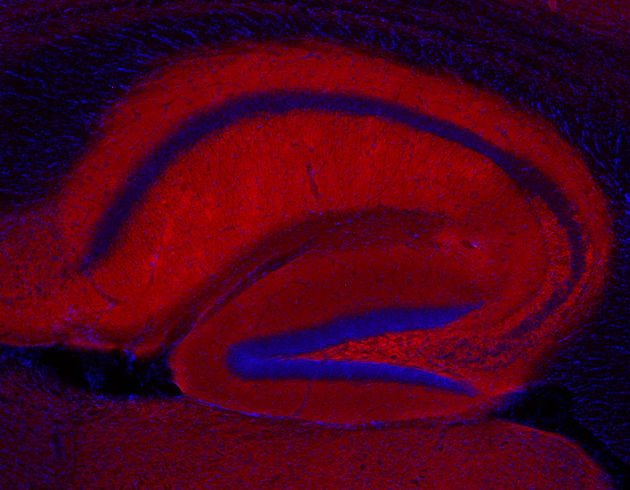 Bassoon Recombinant rabbit - image 3