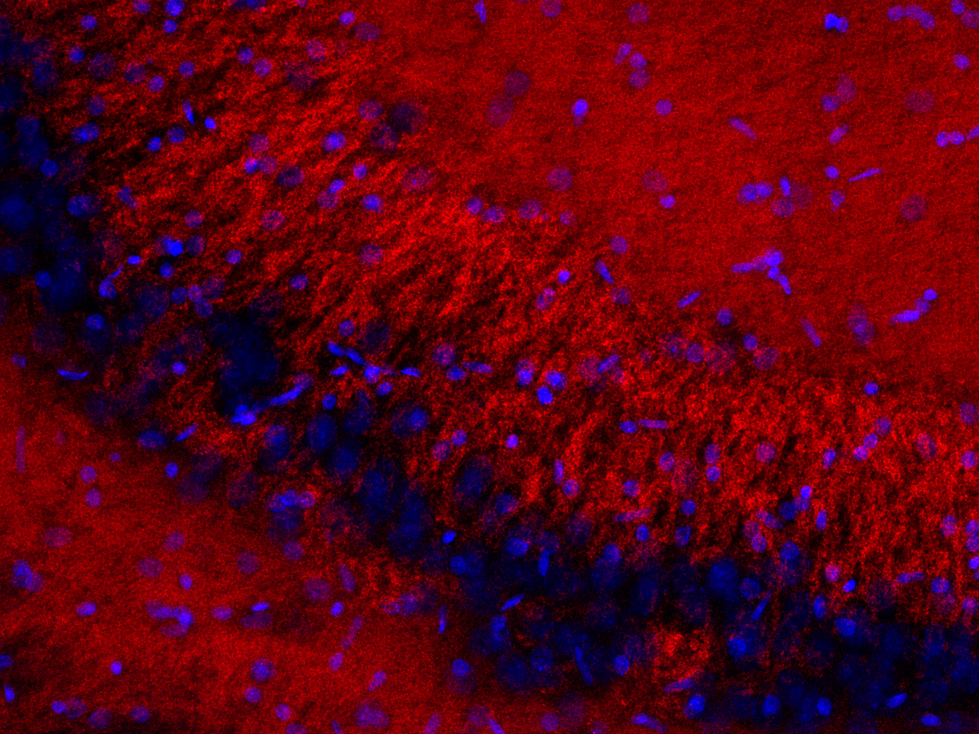 Bassoon Recombinant rabbit - image 5