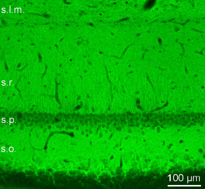 Piccolo Polyclonal rabbit antiserum - image 3