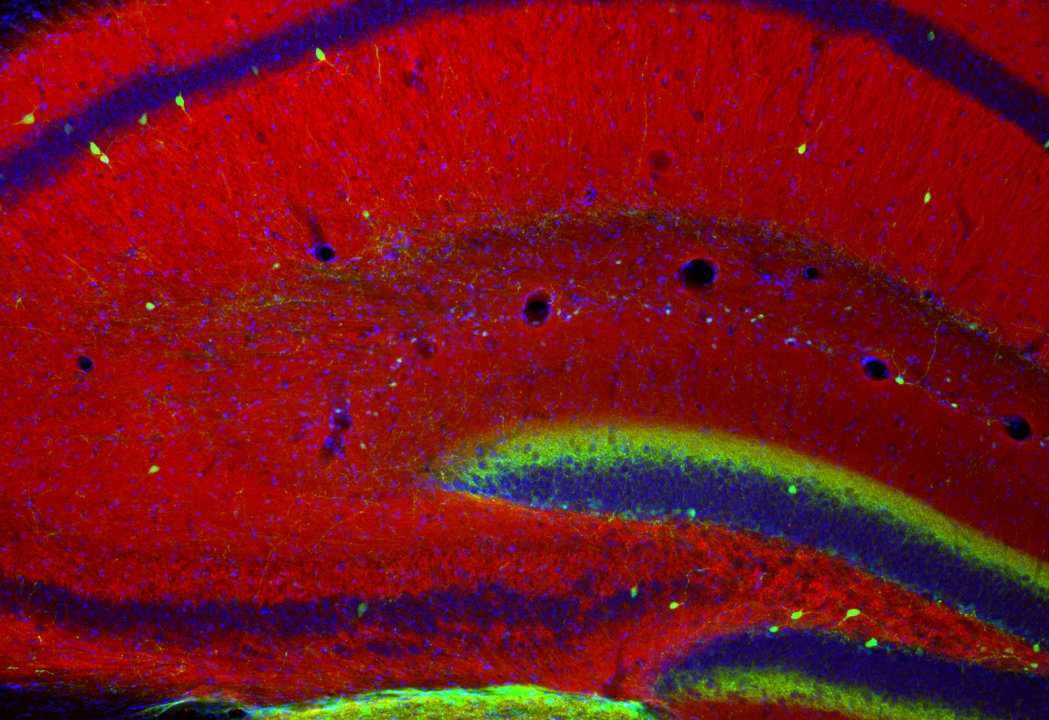 Piccolo Recombinant rabbit - image 4