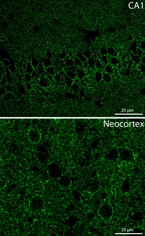 Ca2+ channel N-type alpha-1B Polyclonal rabbit purified antibody - image 2