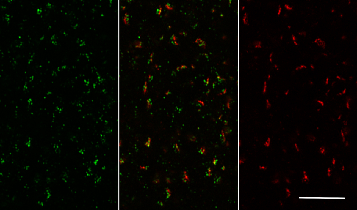 Ca2+ channel N-type alpha-1B Polyclonal rabbit purified antibody - image 3