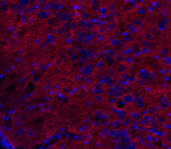CSP Polyclonal Guinea pig antiserum - image 3
