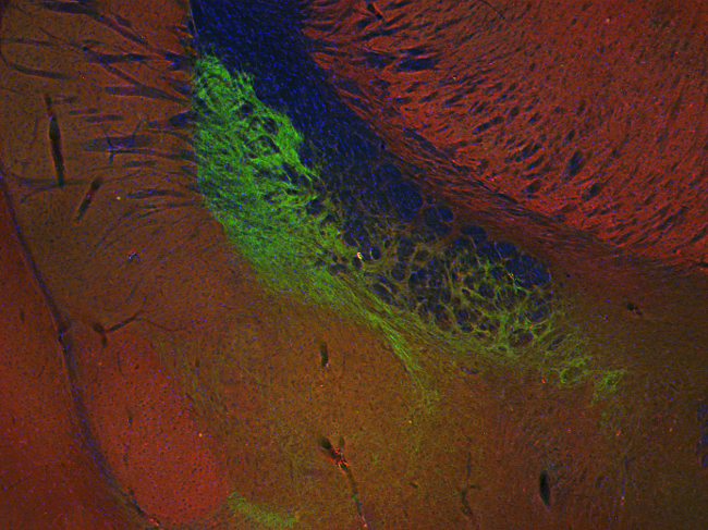 Endophilin1, Polyclonal rabbit antiserum