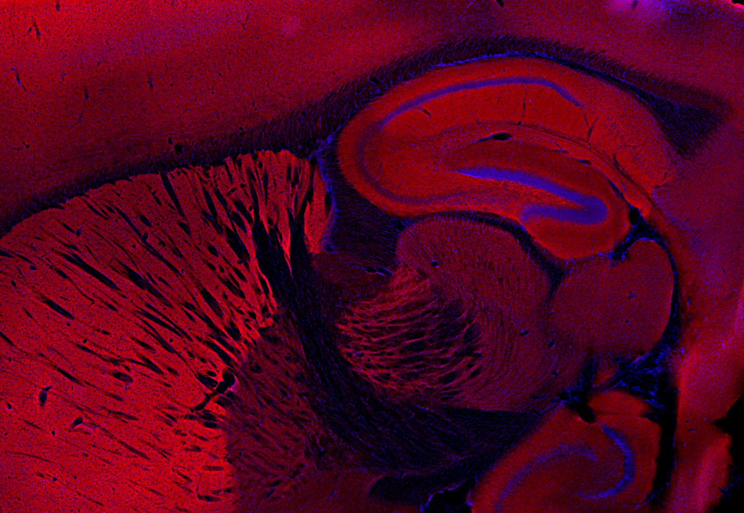 Homer1, Polyclonal rabbit antiserum