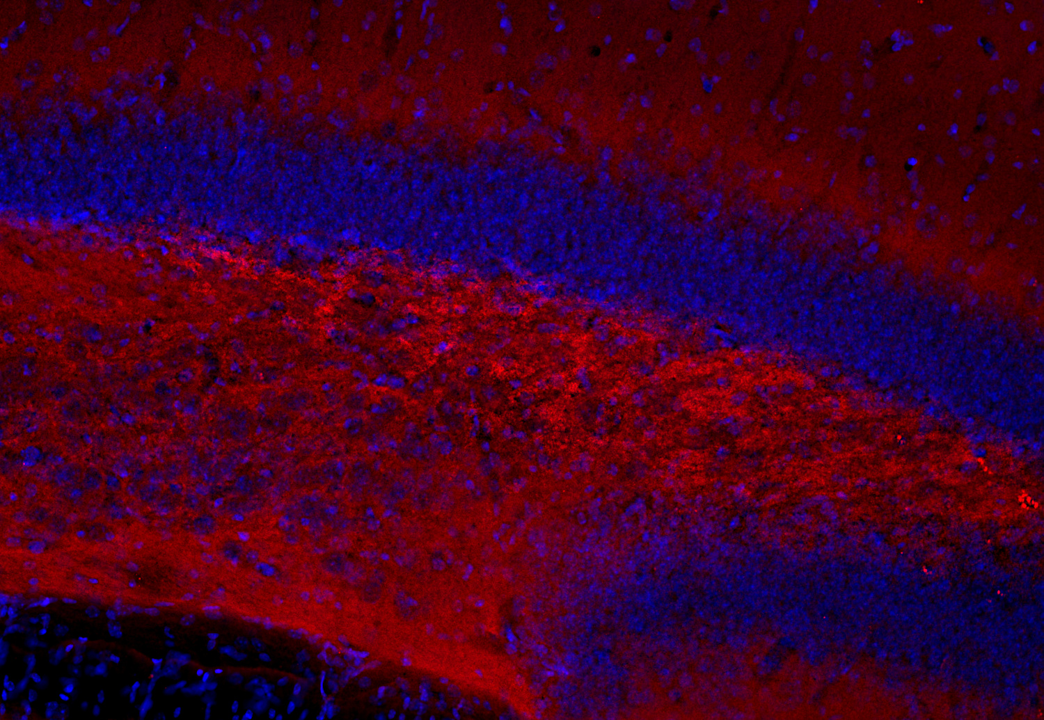 Homer1, Polyclonal rabbit antiserum