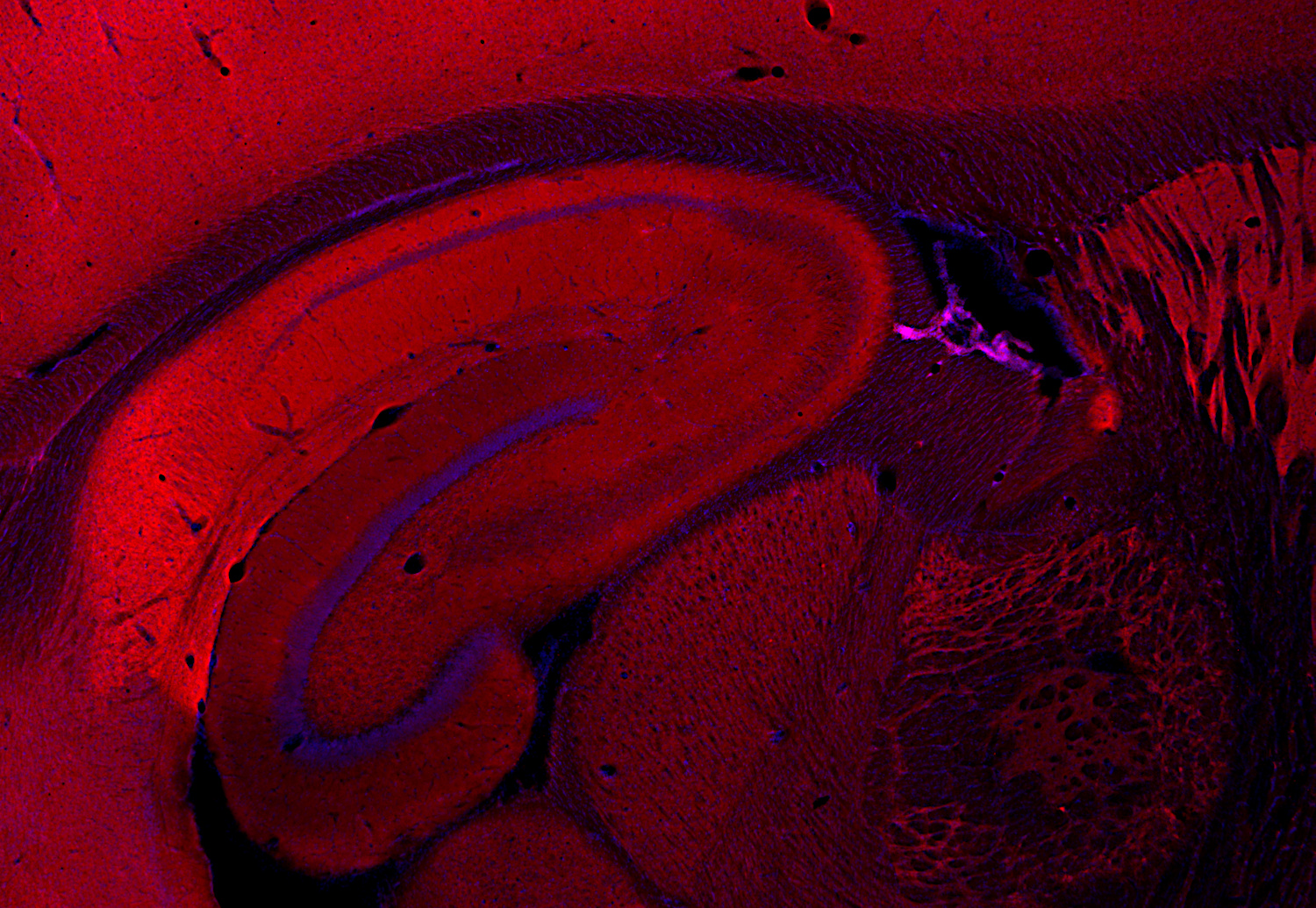 Homer1, Polyclonal rabbit antiserum