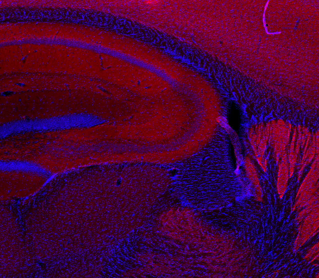 Homer1b/c, Polyclonal Guinea pig purified antibody