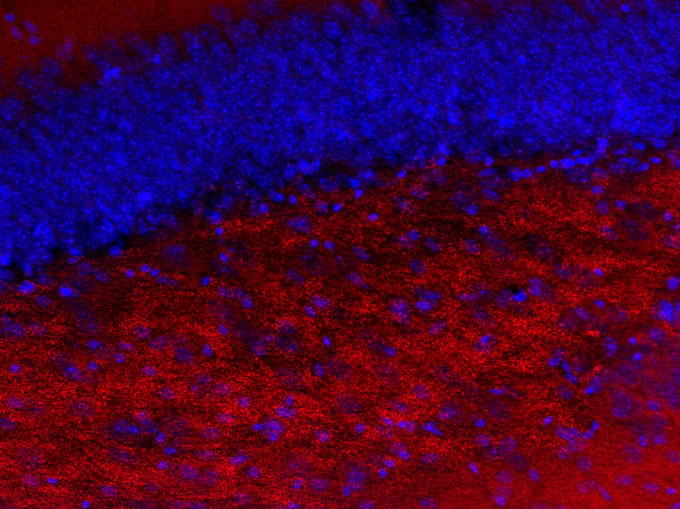 Homer1b/c, Polyclonal Guinea pig purified antibody