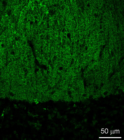 Shank2 Polyclonal Guinea pig antiserum - image 3