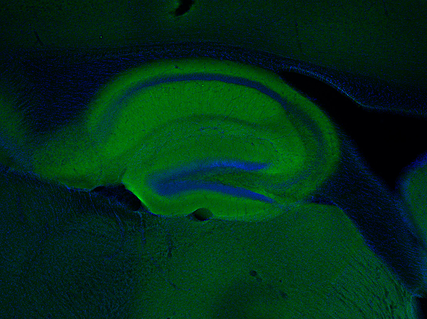 Shank2 Polyclonal Guinea pig antiserum - image 4