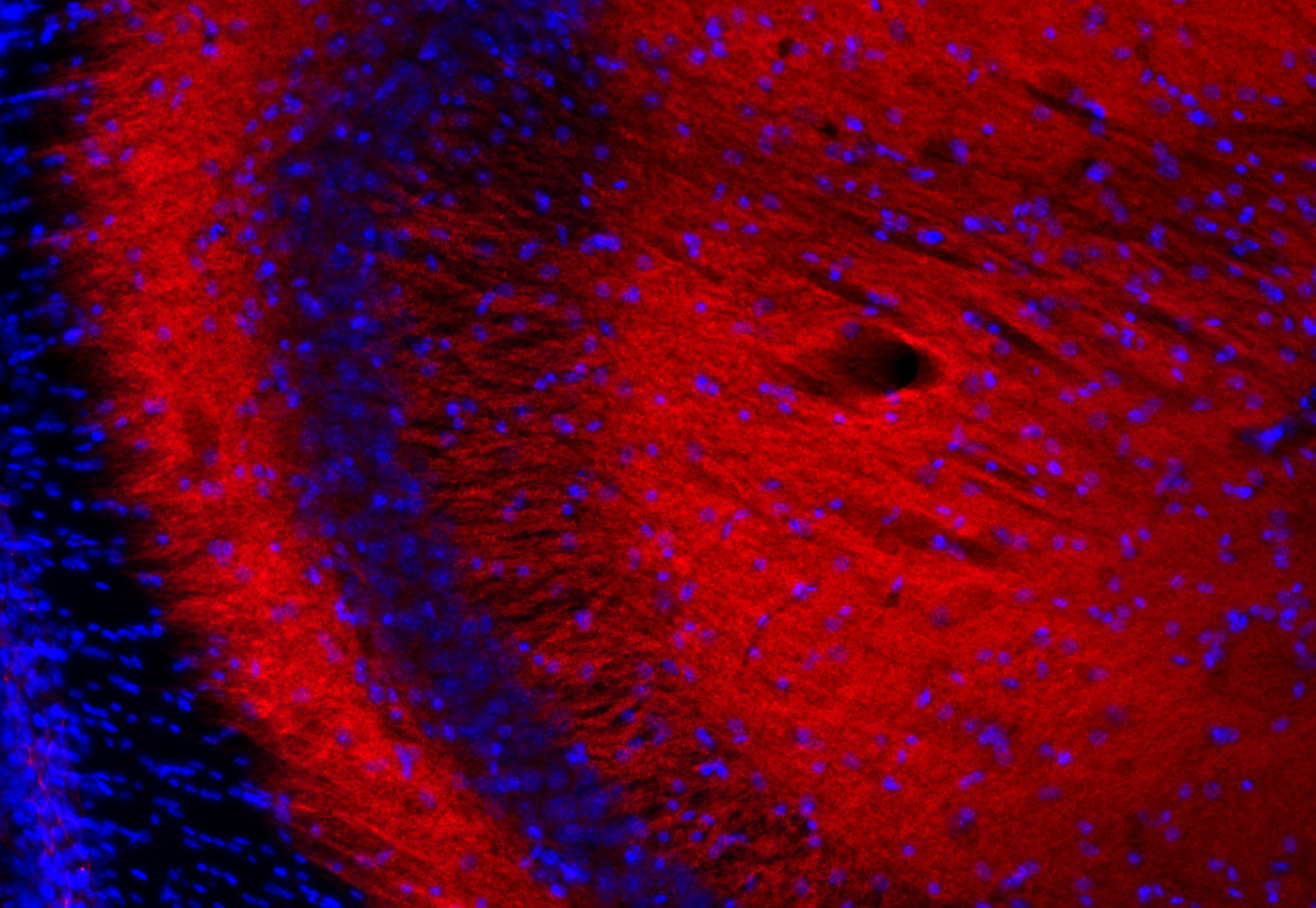 Shank2 Polyclonal Guinea pig antiserum - image 5